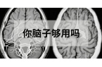 30岁后大脑加速衰老？这五类人正在悄悄「